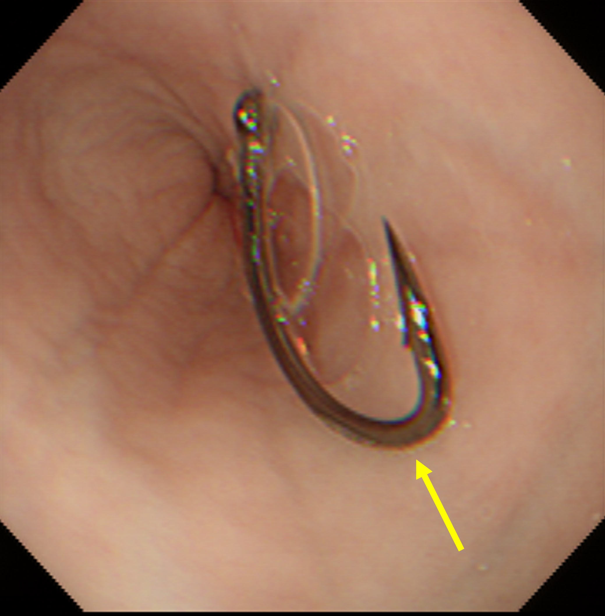 Endoscopic retrieval of foreign bodies Veterinary Practice