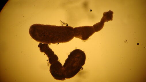 Fig 1. Echinococcus adult tapeworms courtesy of John McGarry, University of Liverpool